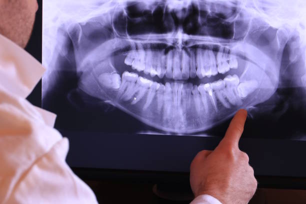 Best Urgent Care for Lost Fillings or Crowns in Farmville, VA