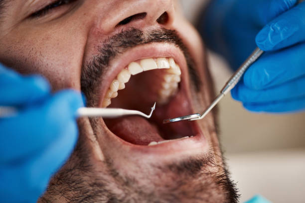 Best Weekend Emergency Dentist in Farmville, VA